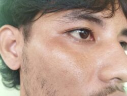 Oknum Pegawai Bagian Bendahara DPRD Kabupaten Bangka Diduga Melakukan Penganiayaan